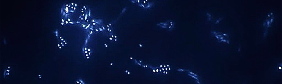 Microbial Dormancy In The Marine Subsurface Diveinside News