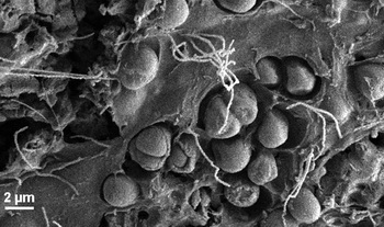 Bakterien, Wimpertierchen und Kieselalgen auf einem Plastikteil (Erik Zettler)